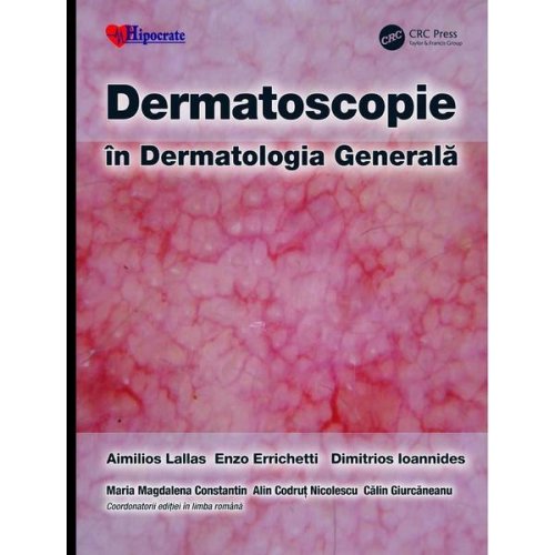 Dermatoscopie in dermatologia generala - aimilios lallas, enzo errichetti, editura hipocrate