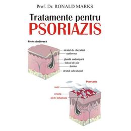 Tratamente pentru psoriazis - ronald marks, editura antet